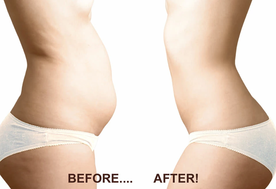 Budget ✔️ Fat Freezer Skin-Protection Pads by Beauty Ko LLC 😀 - Image 2