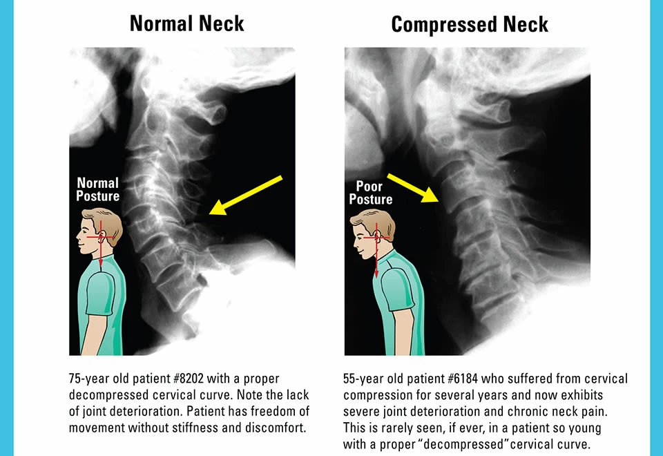 Cheapest ๐ At Home Neck and Back Pain Reliever by POSTURE PRO, INC. ๐ - Image 3