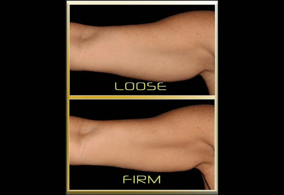 Wholesale ๐งจ Underarm Toner by Beauty Ko LLC ๐ - Image 2